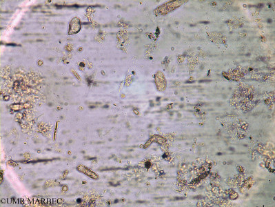 phyto/Brazilian_Amazon_coast/Amazomix_station_18/AMAZOMIX September 2021/Corethron pennatum (Am_ST18_int2_corethron_cf_criophilum240903_002)(copy)_thumb.jpg